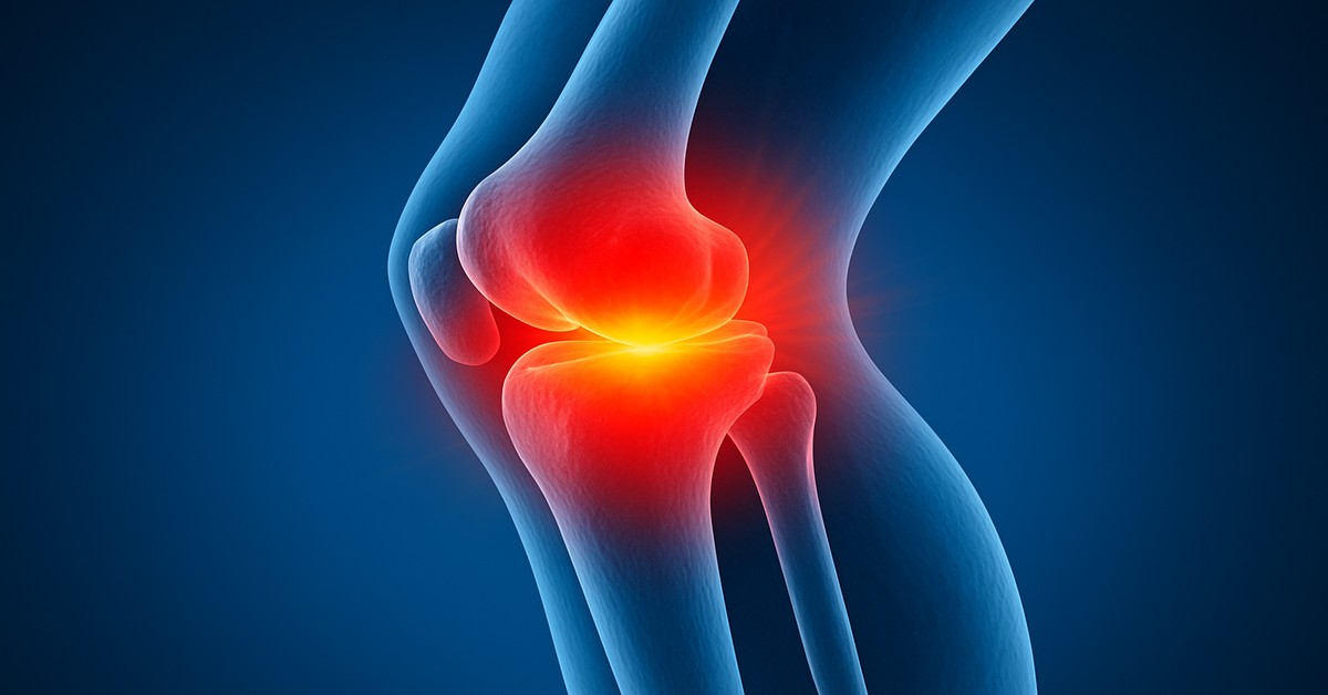Best Natural Supplements to Reduce Inflammation in the Joints