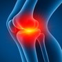 Best Natural Supplements to Reduce Inflammation in the Joints